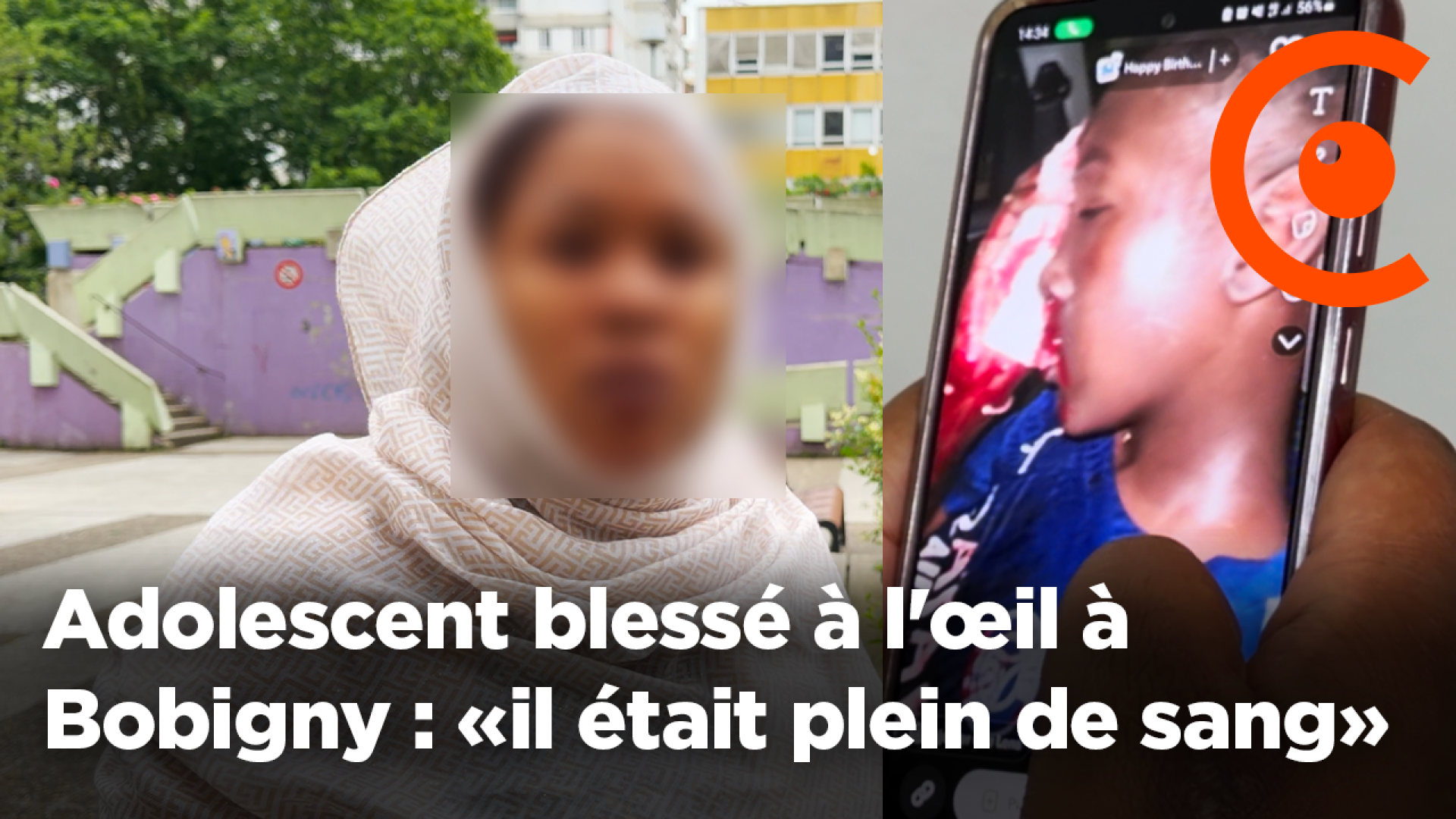 Injured teen in the eye in Bobigny: testimony from the woman who transported the young teenager to the hospital