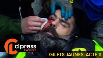 Gilets jaunes Acte 11 : Jérôme Rodrigues, gravement blessé à l’œil 